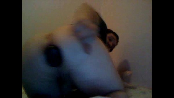 b. Anal Missle Gape